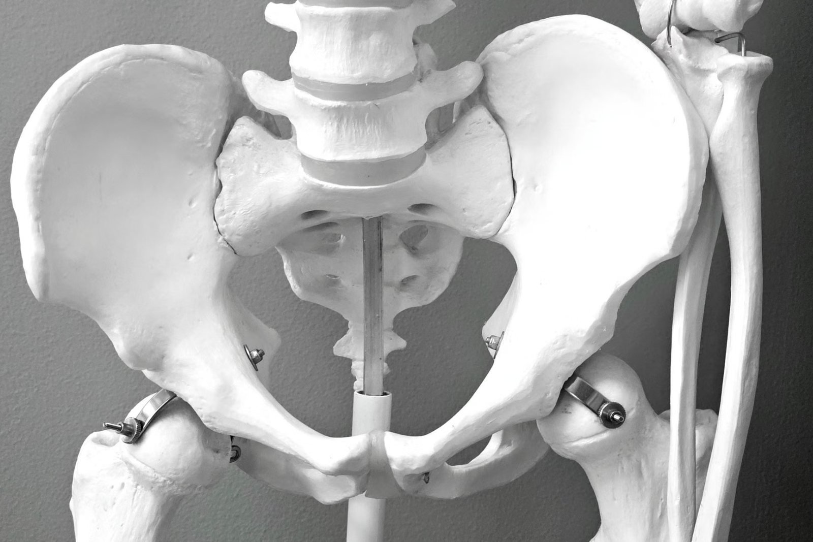 An anatomical model of the pelvis and hips, the area a DEXA scan measures