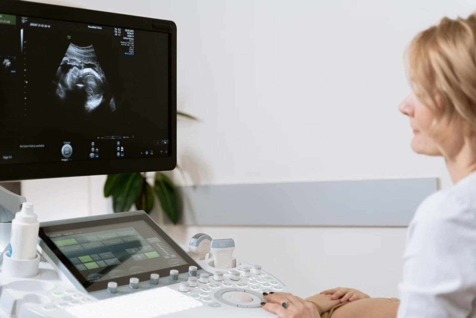 A clinician beside an ultrasound machine