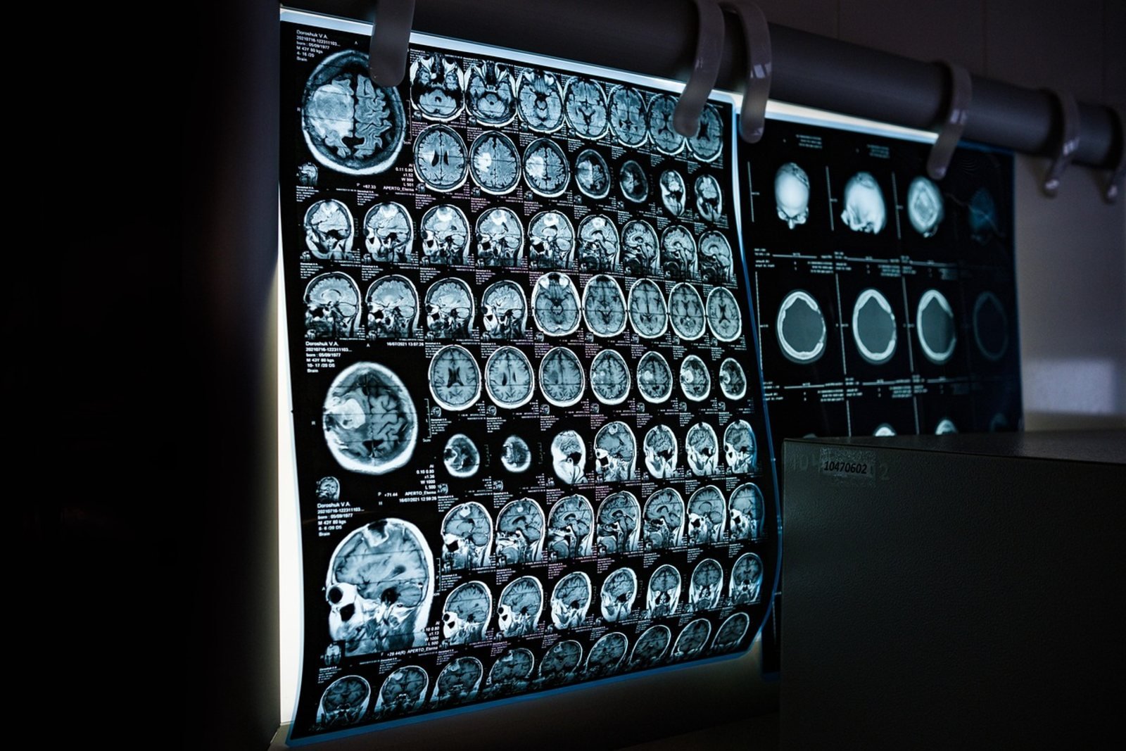 CT Scan Guides | Cost, Radiation Dose and Referrals | FindScan