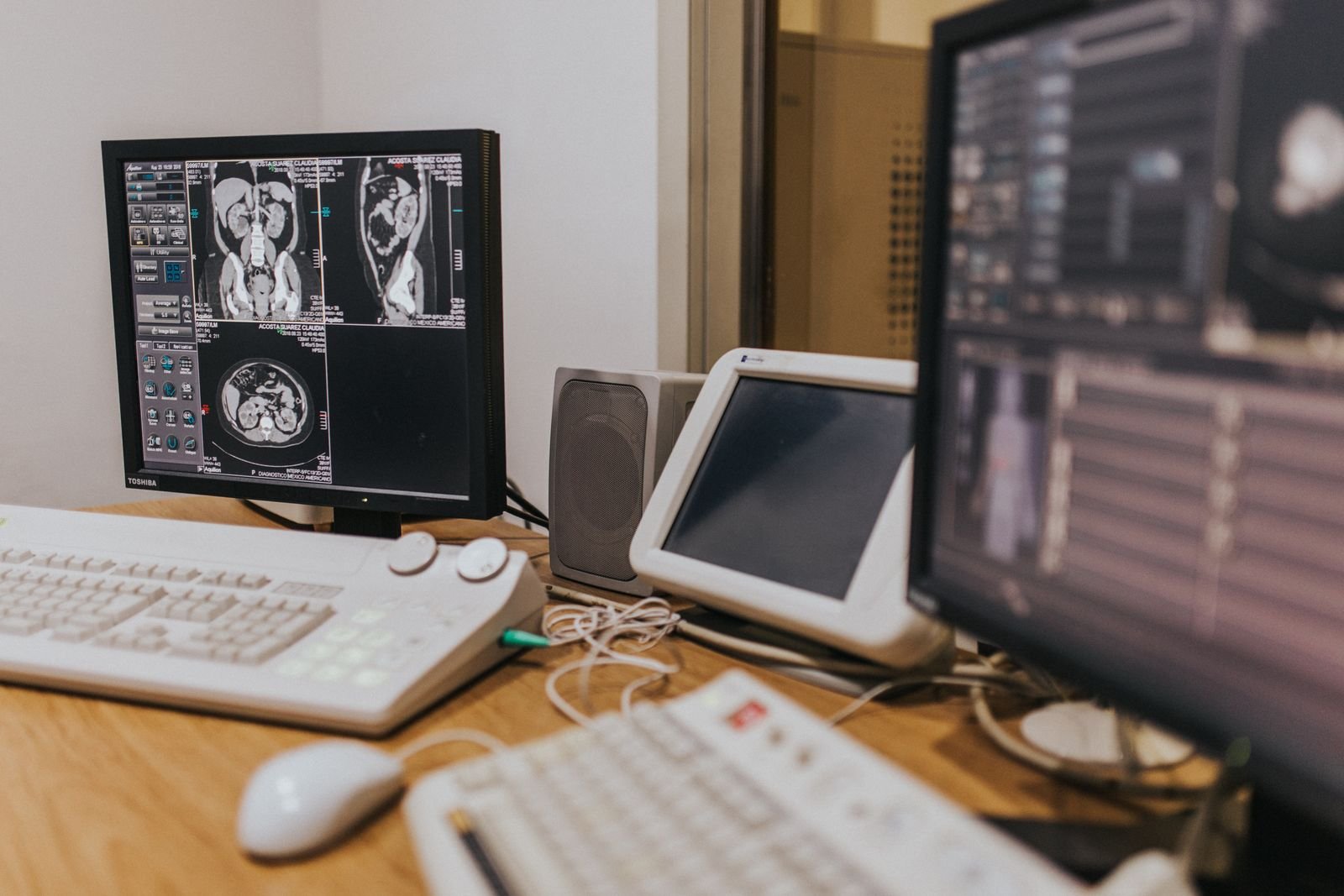 Brain MRI images displayed on reading room monitors