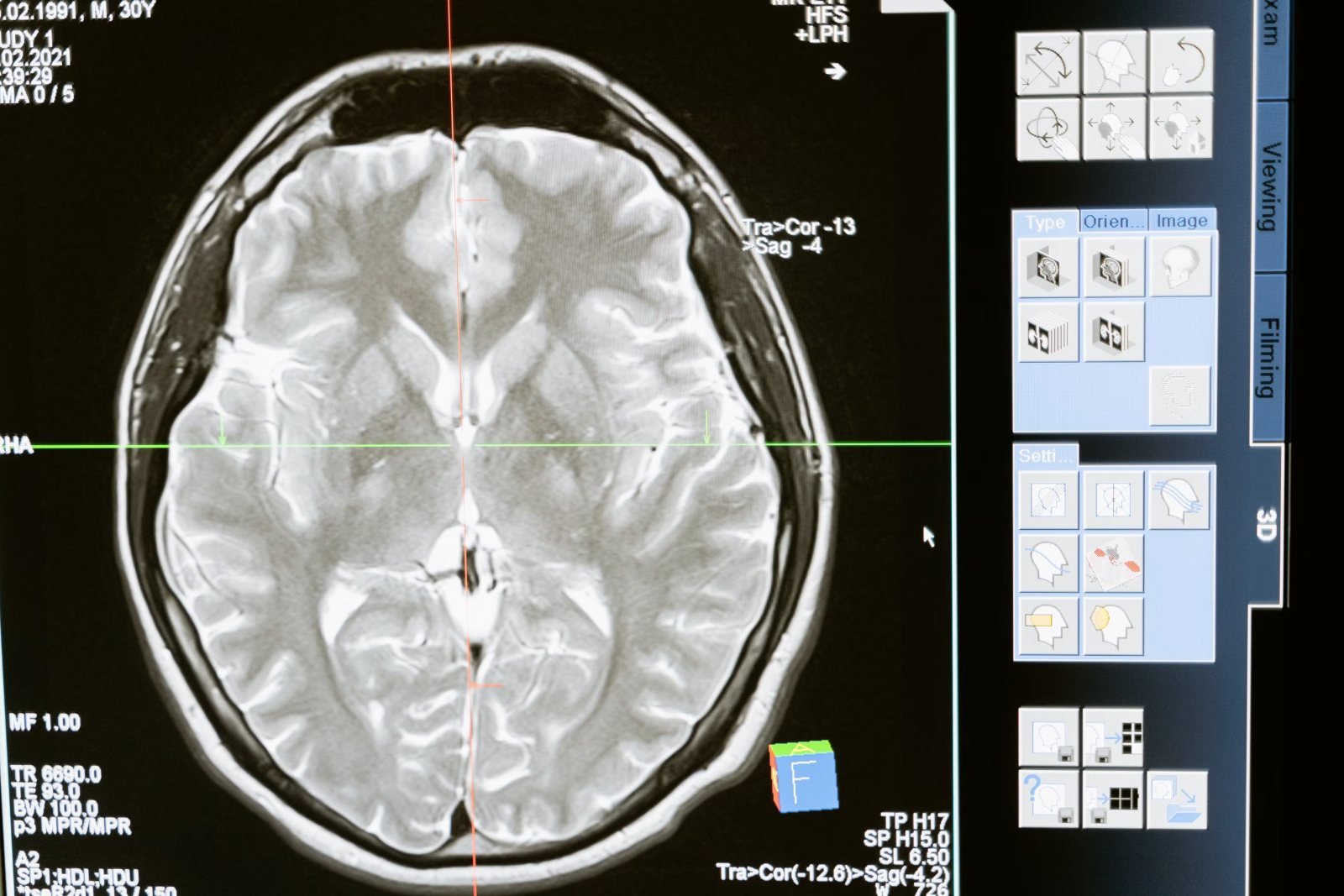 A brain MRI open on a reporting workstation