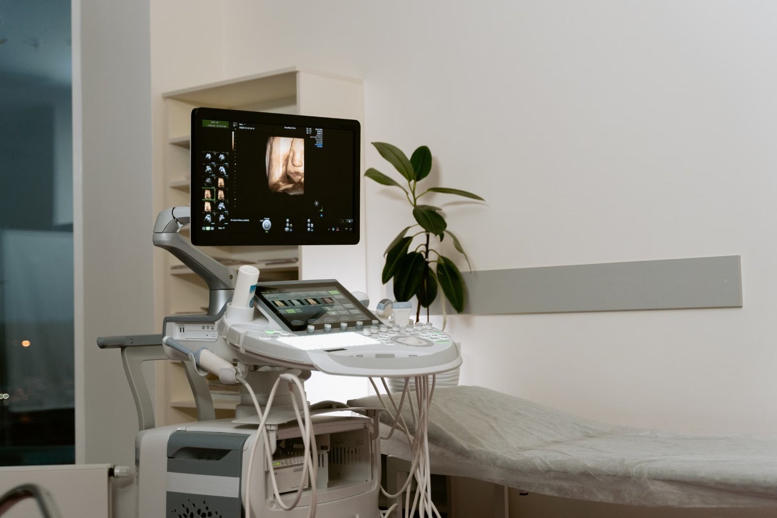 The control panel of an ultrasound machine
