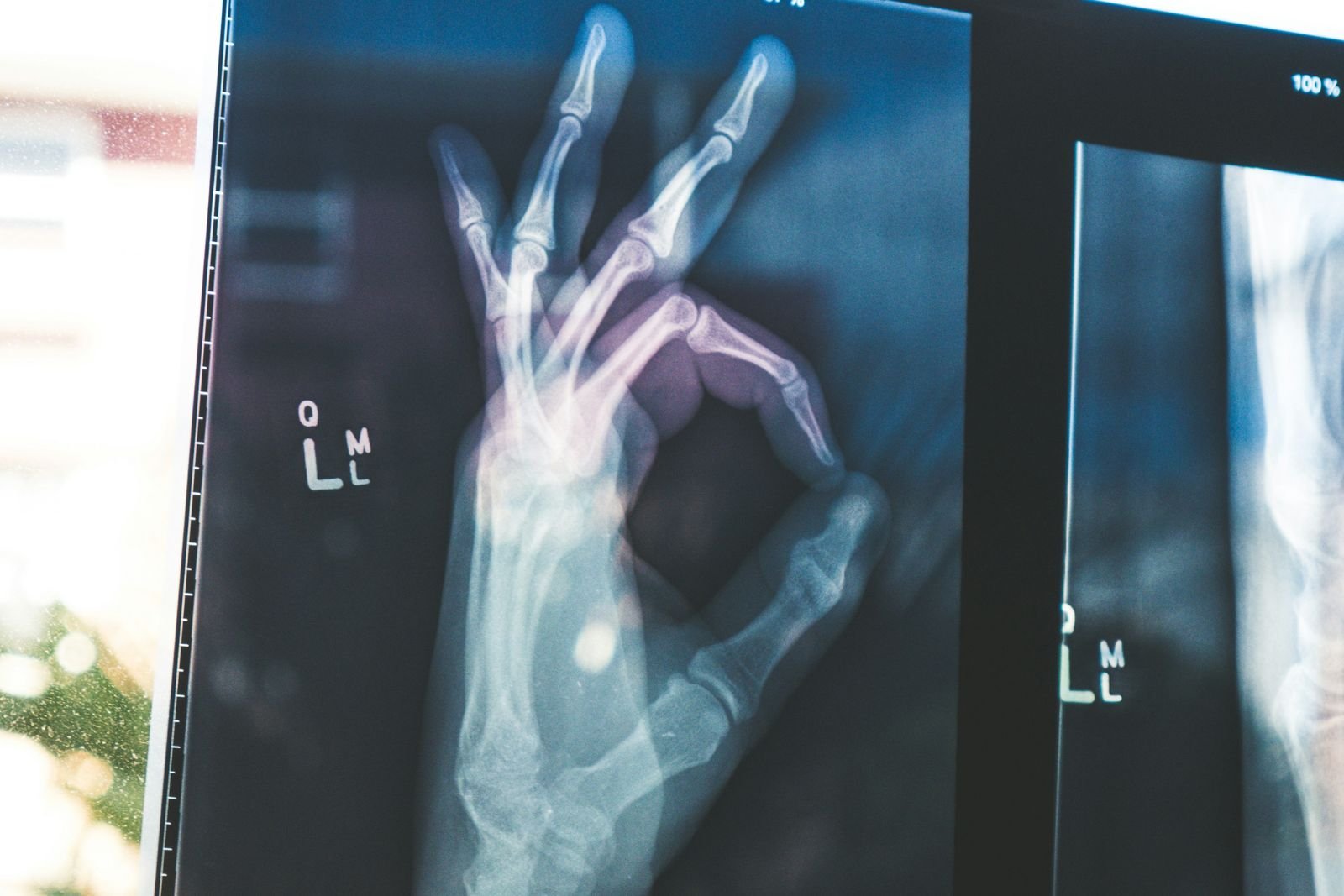 X-ray at a private imaging clinic in Bath