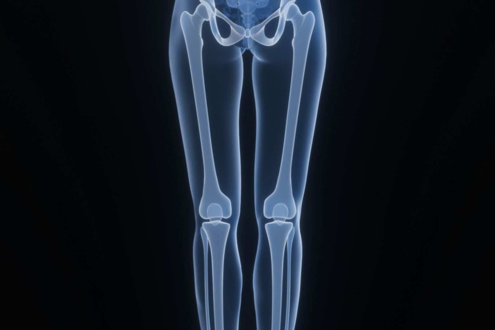 An illustration of the leg bones as they appear on X-ray